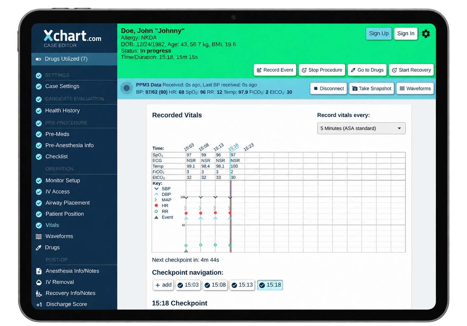 Xchart anesthesia tracking software showing recorded vitals on a modern iPad
